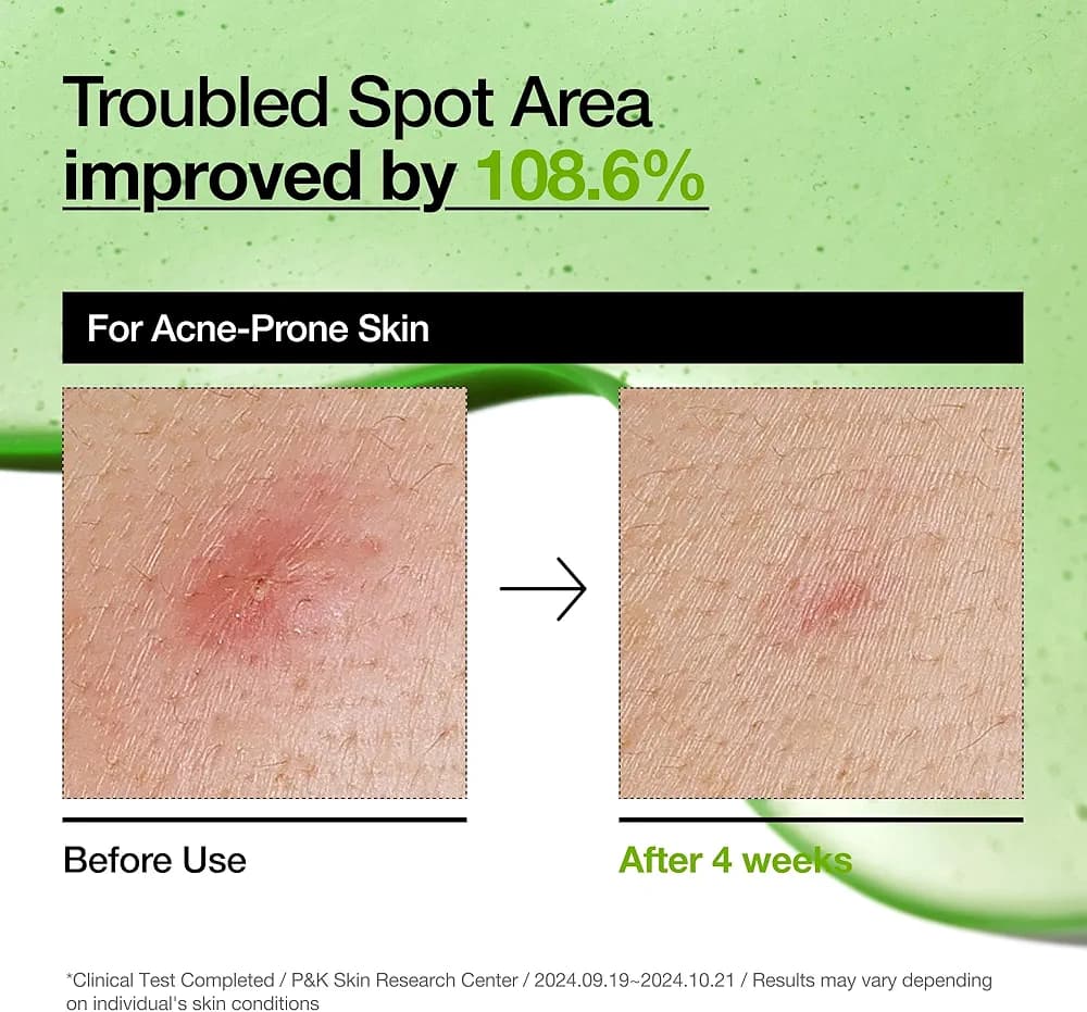 Anua Azelaic Acid 10 Hyaluron : Redness Soothing Serum