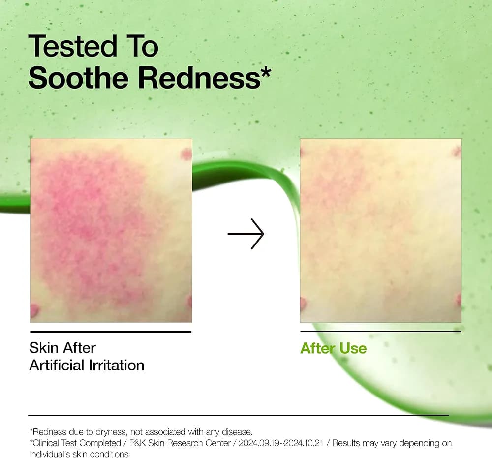 Anua Azelaic Acid 10 Hyaluron : Redness Soothing Serum