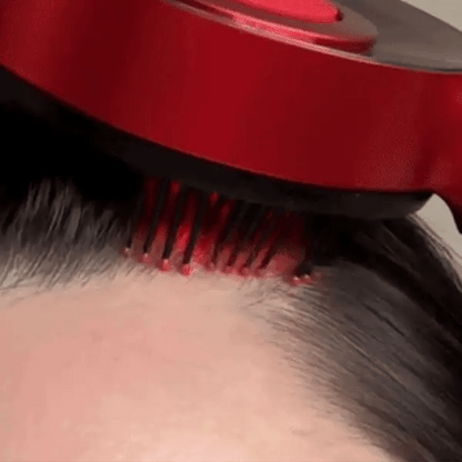 Sharple™ - Hair Scalp Massager Comb